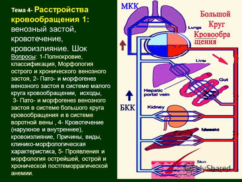 Венозный застой. Механизм застоя в Малом круге кровообращения. Венозный застой в системе малого круга кровообращения. Причины острого венозного застоя в Малом круге кровообращения. Венозный застой в Малом круге кровообращения патогенез.