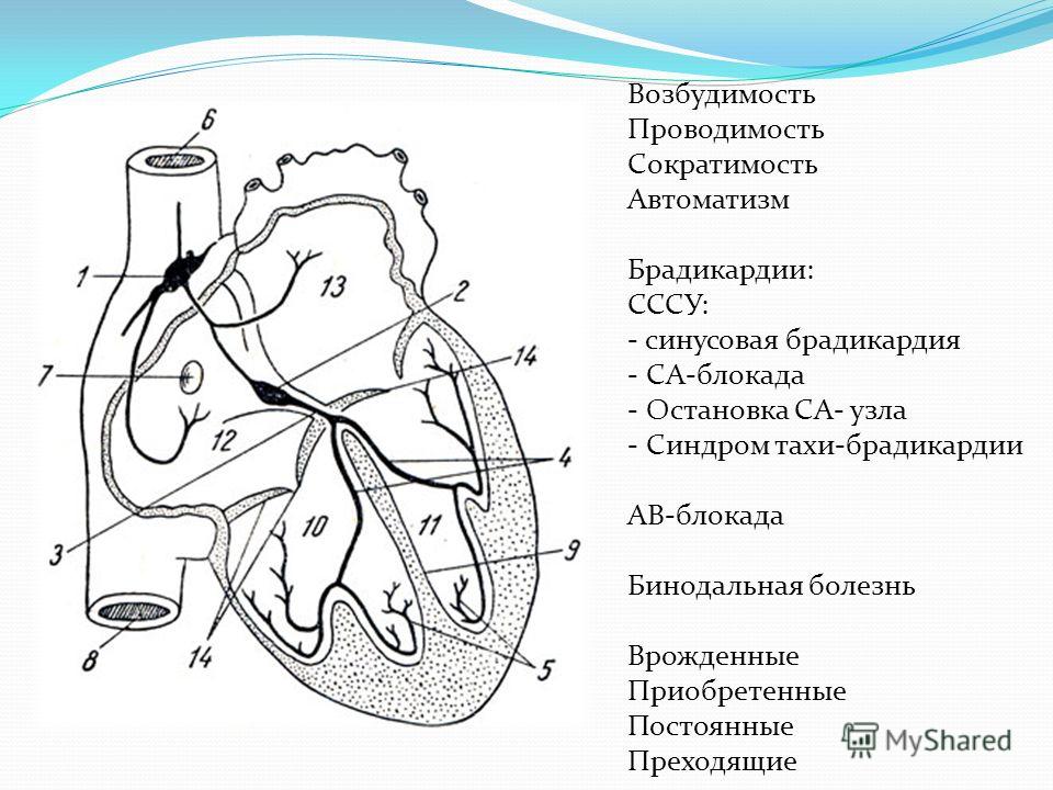 Проводящая система проводит. Проводящая система сердца ее структура функции. Зарисовать схему проводящей системы сердца. Проводящая система сердца узлы пучки волокна. Проводящая система сердца механизм.