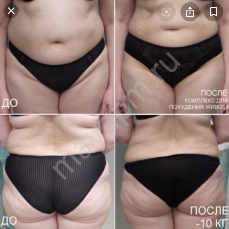 Ручной массаж живота для похудения фото до и после