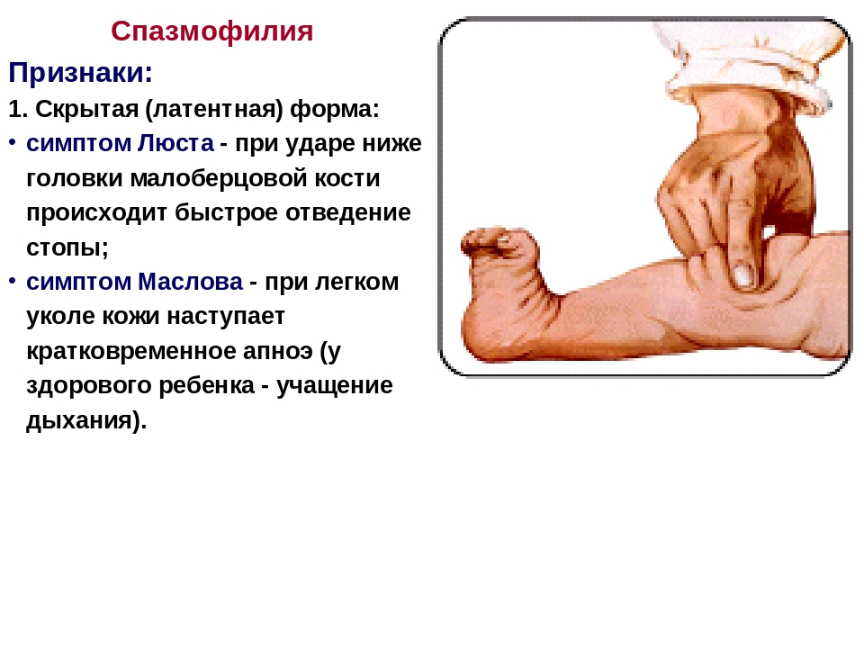 Спазмофилия презентация по педиатрии