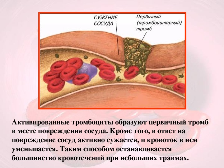 Возникновение тромбов. Места образования тромбов. Причины образования тромбов в сосудах.