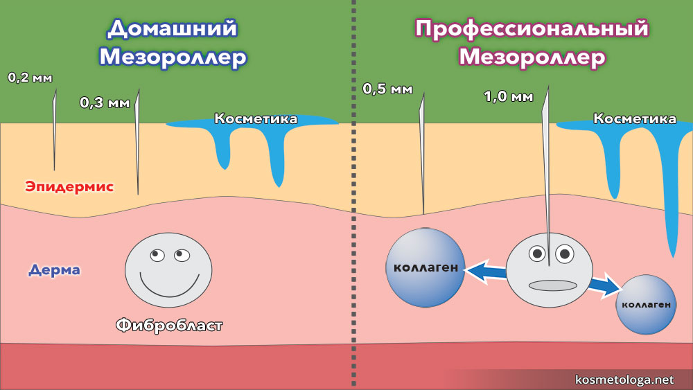 Домашний мезороллер проникает в кожу не так глубоко как профессиональный