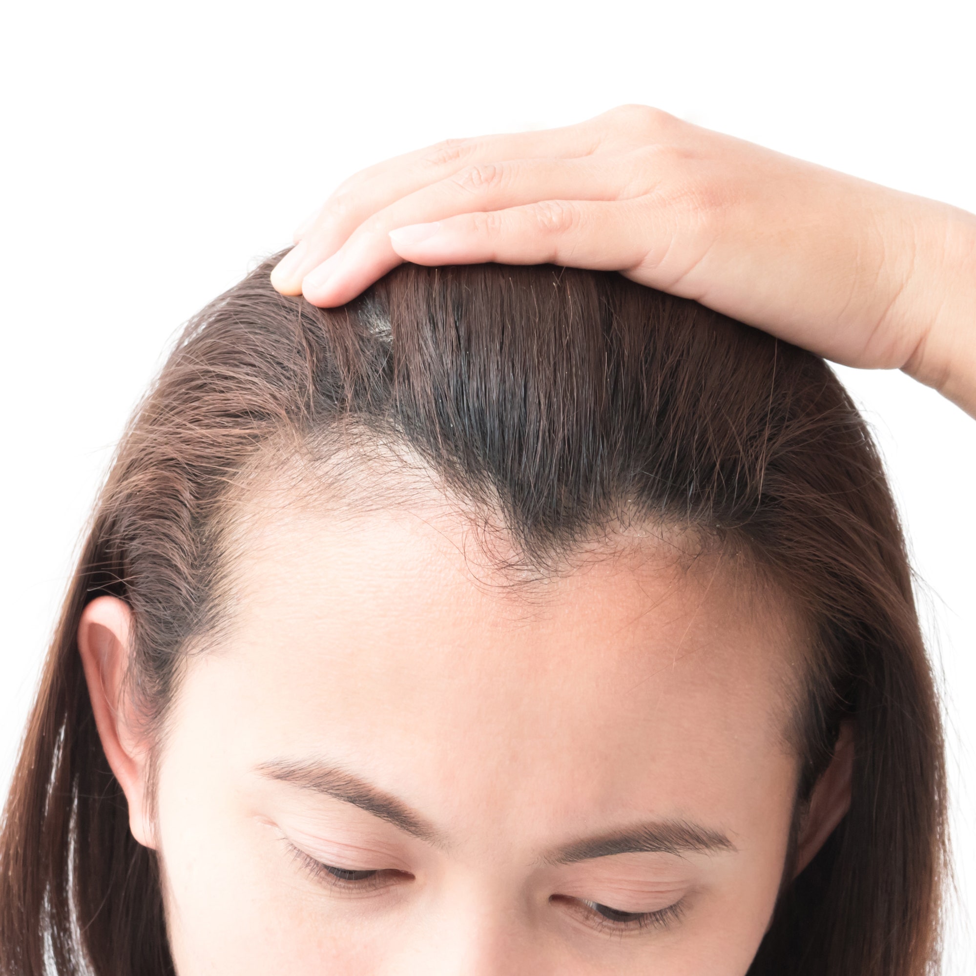 Как лечат выпадение волос в китае