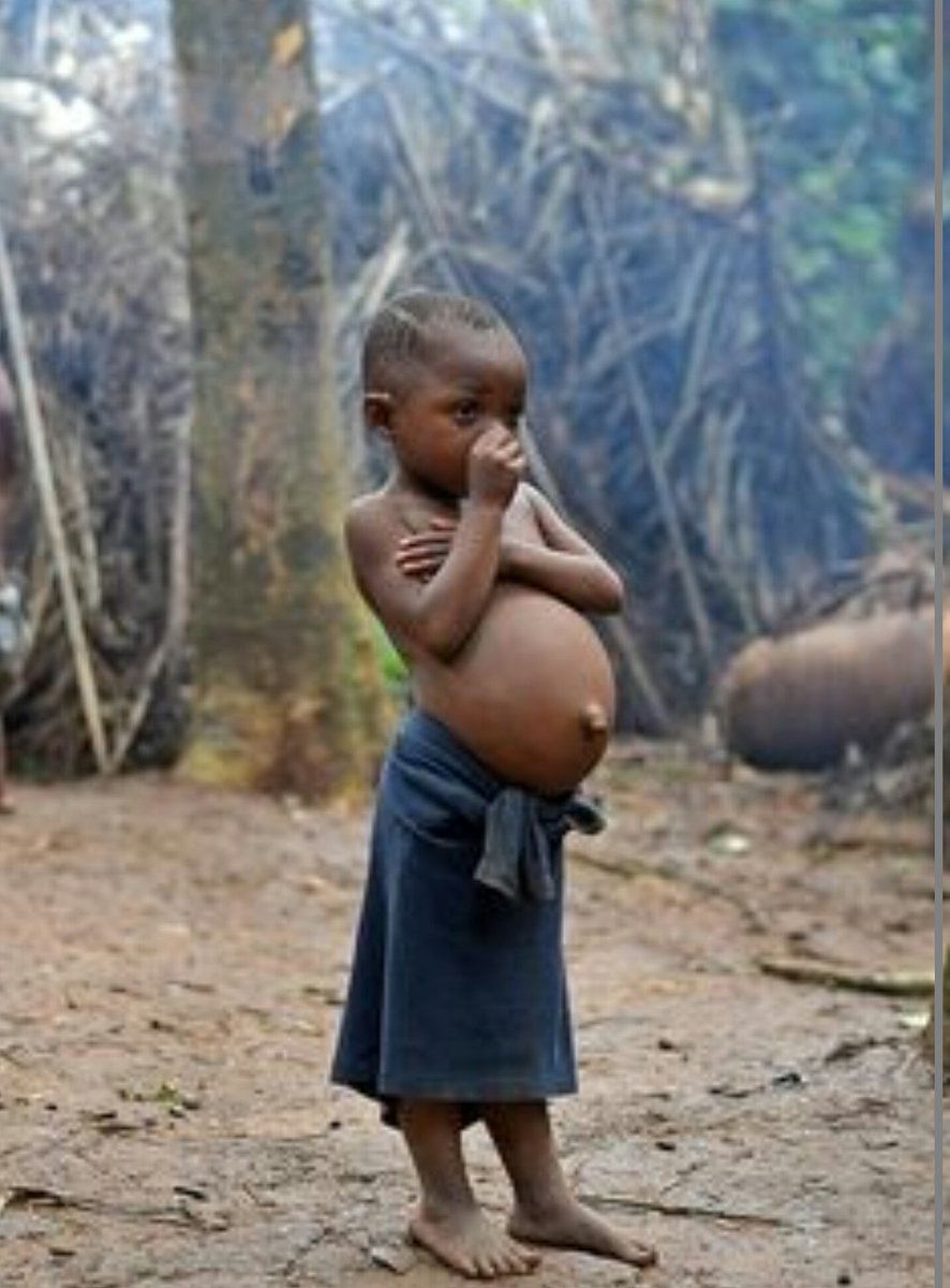 Голову в голоде живот в. Африканские Дели с жмвотом. Африканские дети с животами.