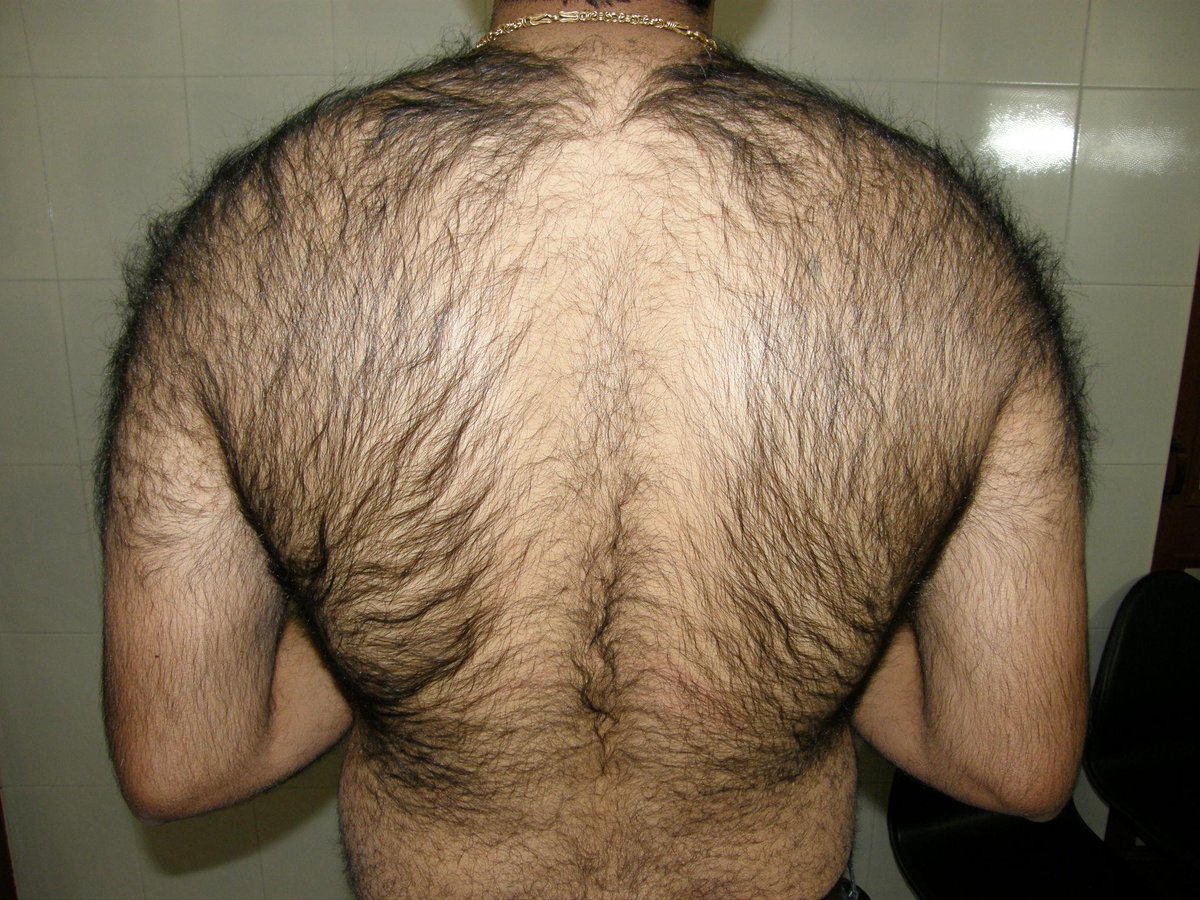 волосы на груди у женщин сонник (120) фото