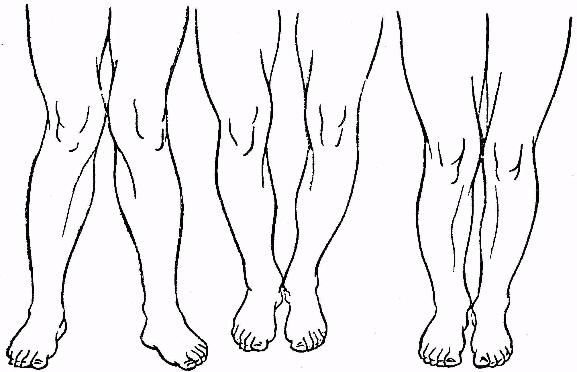 Форма ног