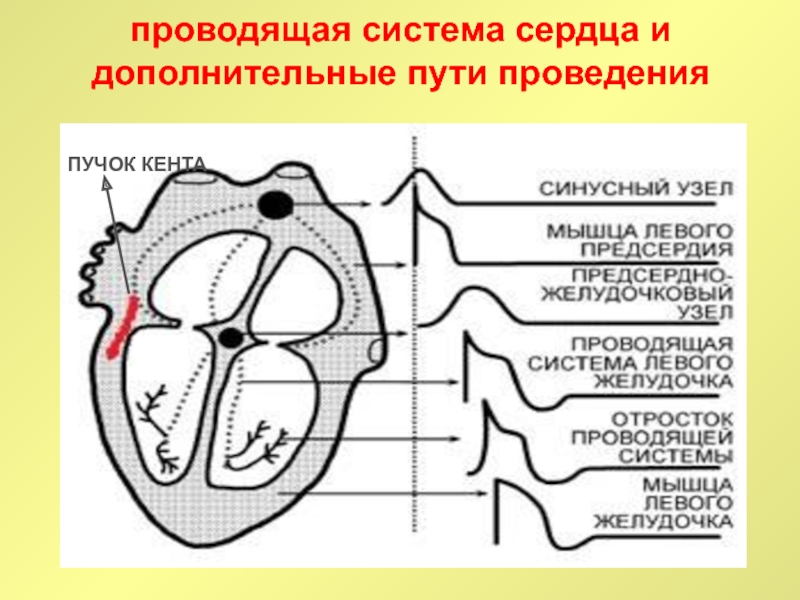 Проводящая система сердца проводит. Проводящая система сердца пучок Кента. Проводящая система сердца патологические пучки. Проводящая система сердца схема дополнительные пути проведения. Проводящая система сердца фронтальный срез.